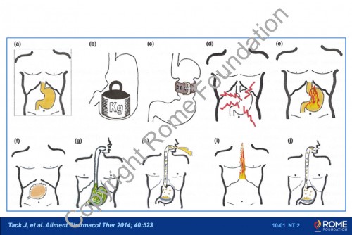 Chapter 10 - Gastroduodenal
